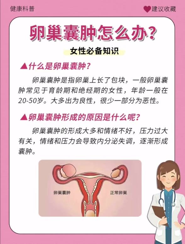 女性都会担心的卵巢囊肿!如何预防呢