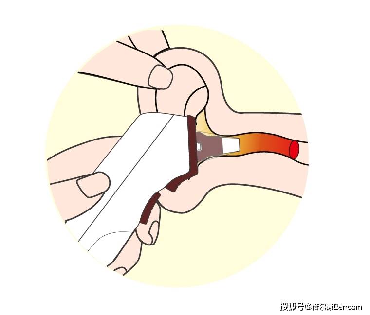 耳温枪测温为什么两个耳朵温度不一样