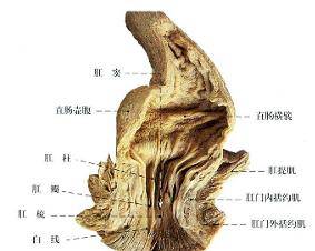 复兴中医肛肠:中医治疗高位复杂性肛瘘伴有肛门松弛