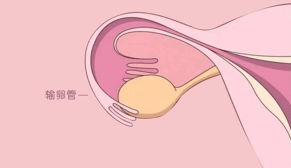 切掉一侧输卵管有什么影响？想要尽快怀孕该怎么办？