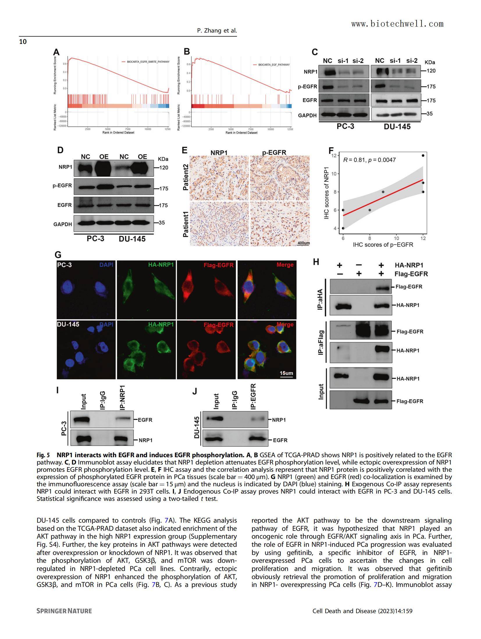 上海威奥前列腺癌组织芯片文献13
