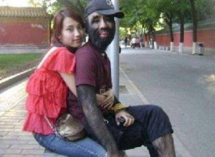 当年轰动一时的"毛孩":42岁娶90后娇妻,生下一子未遗传长毛