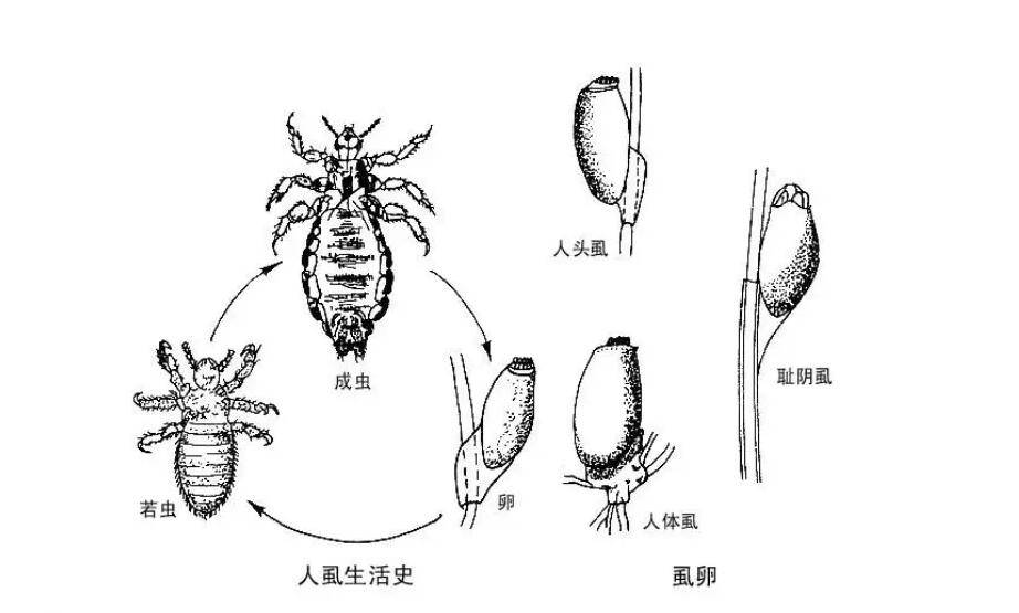 怎么知道得了阴虱图片