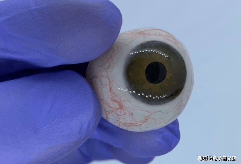 定制义眼片,以后需要调整吗?