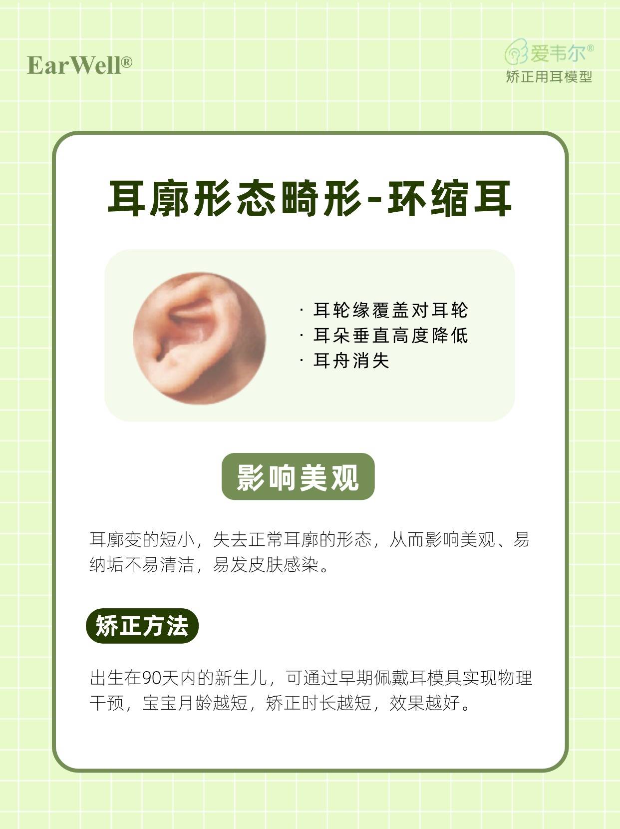 8种新生儿耳朵畸形类型!