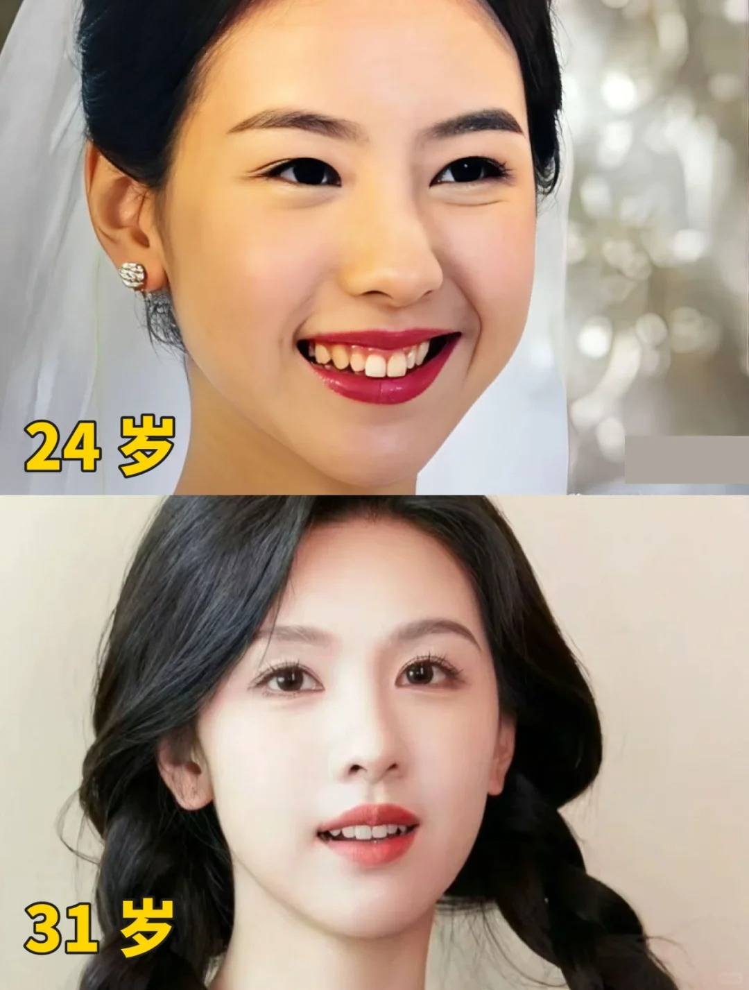 邢台特聘正畸专家周冠军:揭秘《国家宝藏》陈都灵的变美秘诀_牙齿