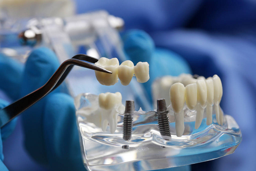 记者暗访揭秘西安种植牙猫腻,别想着一夜改变"种牙贵"