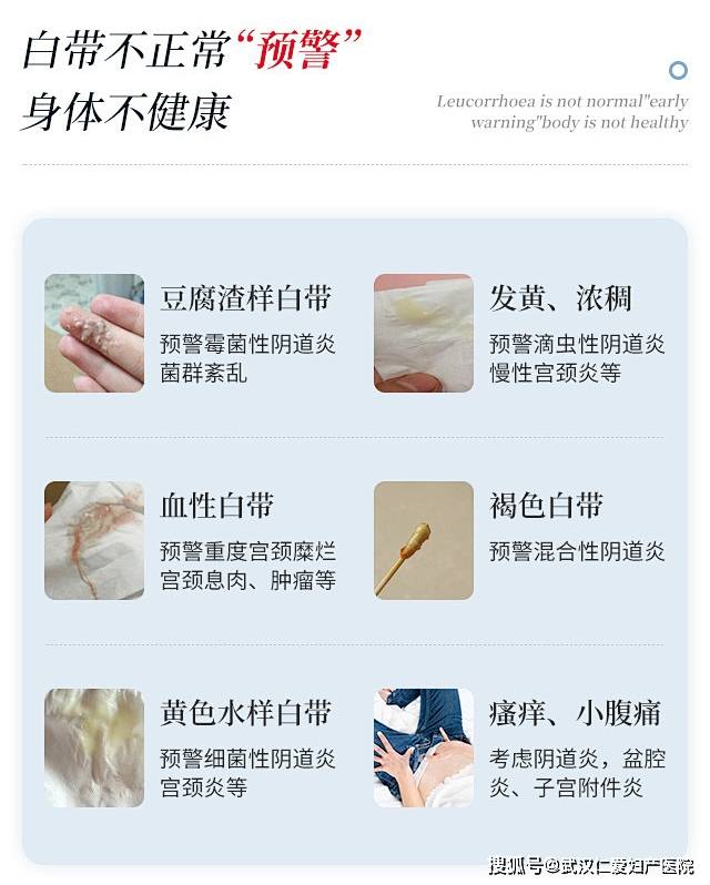 豆腐渣分泌物照片图片