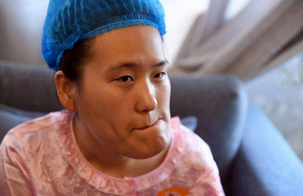 回顾辽宁歪脸女孩,年少父母双亡,拒百万年薪只为初心,如今怎样