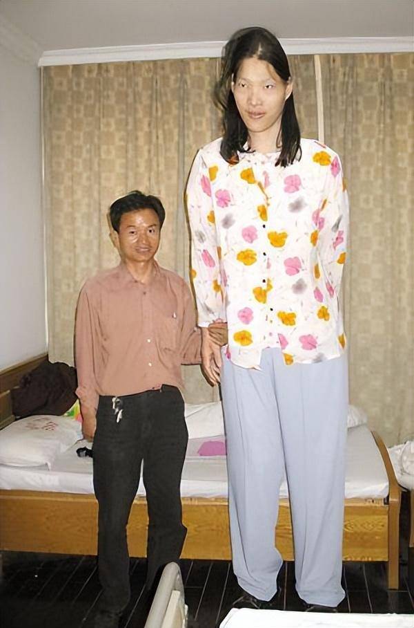 回顾安徽"女巨人":穿78码鞋,一顿吃6碗面,比姚明还高