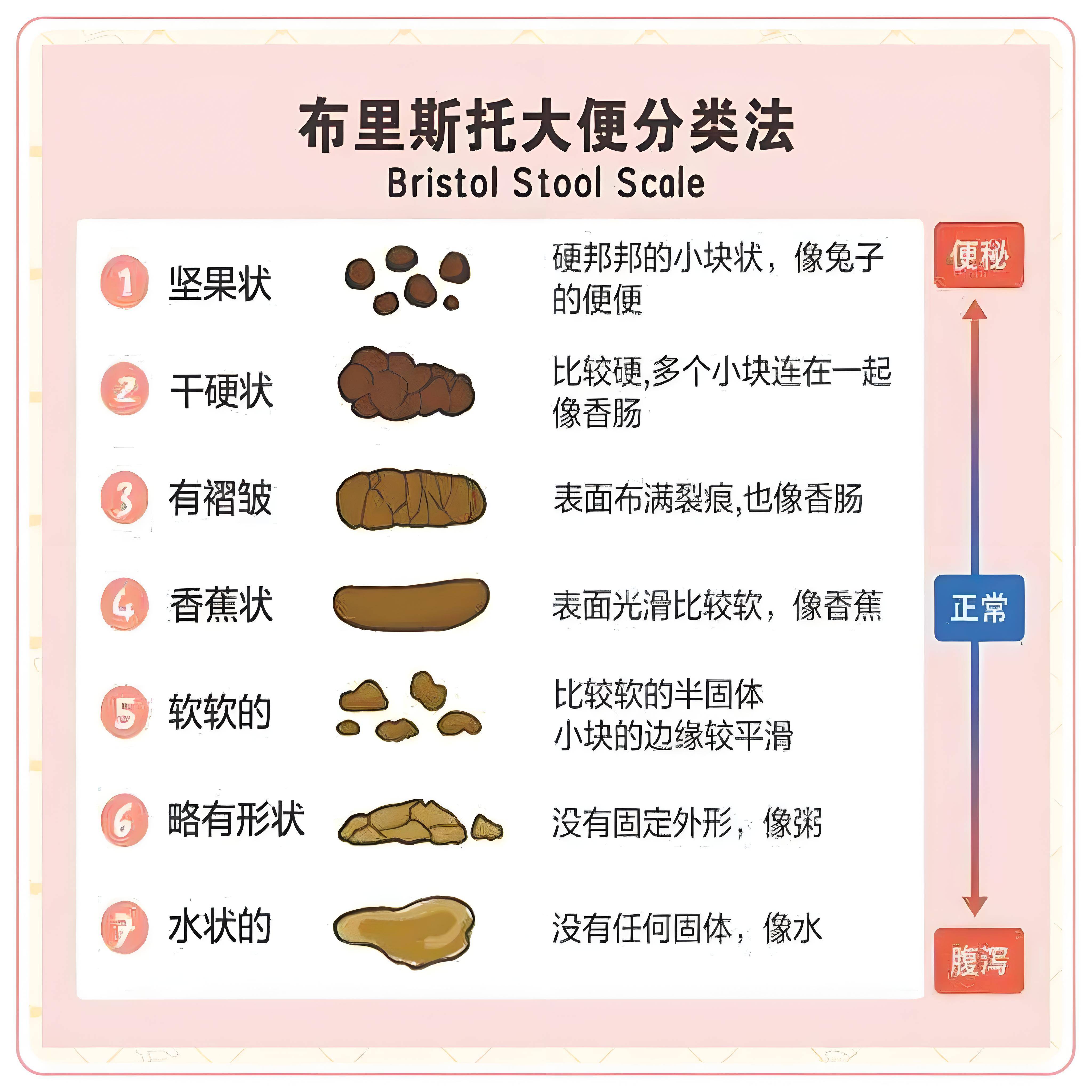 肠癌大便凹槽图片图片