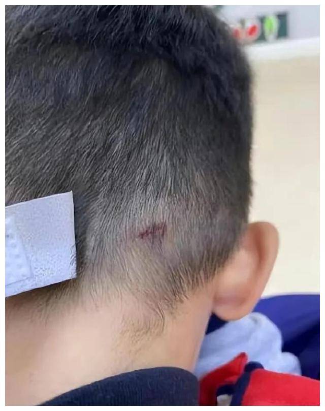 男子上别人家打孩子,一巴掌把小事打成了大事