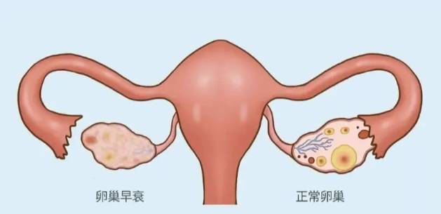 卵巢功能衰退有哪些常见的表现(附4个症状)