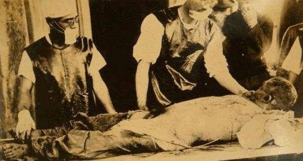 那些被活体解剖致死的人,给他们留下了恐怖的回忆.