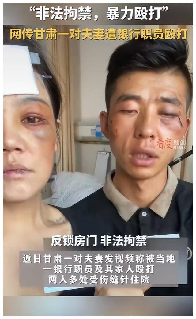 电话机接口不够怎么办(电话机接口不够怎么办视频)