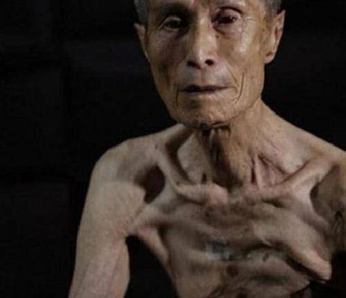广岛核爆后的幸存者,面对镜头哭诉:人类为何要制造这种"怪物"