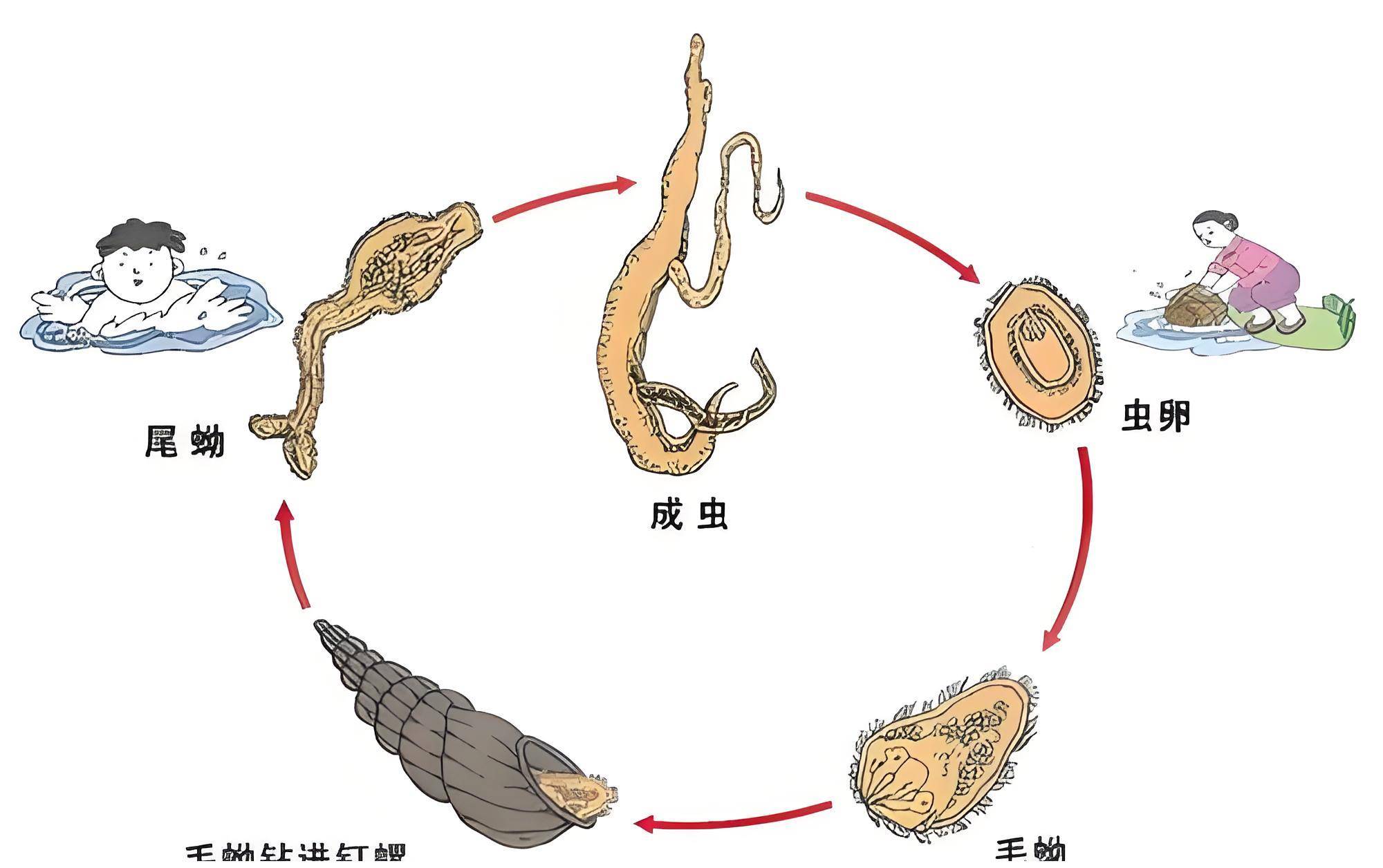 怎么判断大人肚子有虫图片