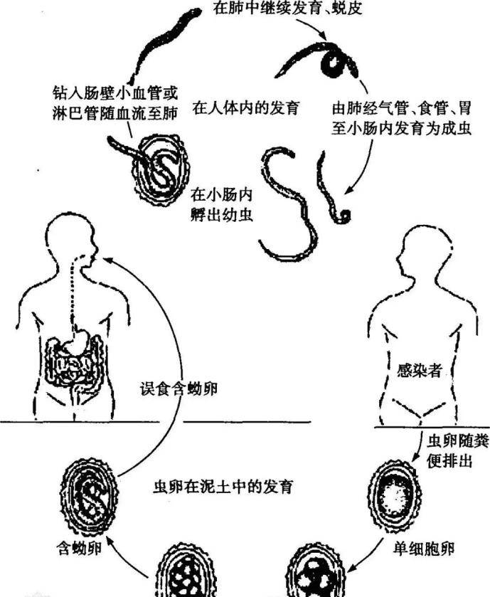 蛔虫简笔画图片大全图片