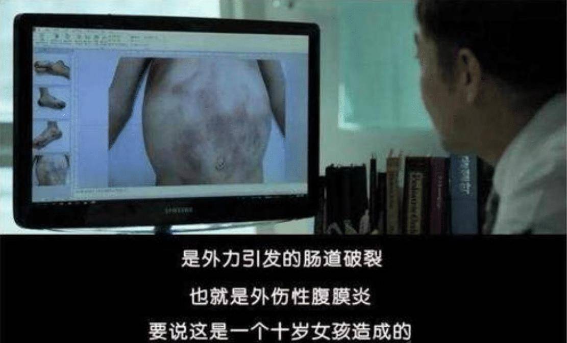 2013年8月,韩国漆谷郡医院迎来一名需要急救的8岁小姑娘,她腹痛不止