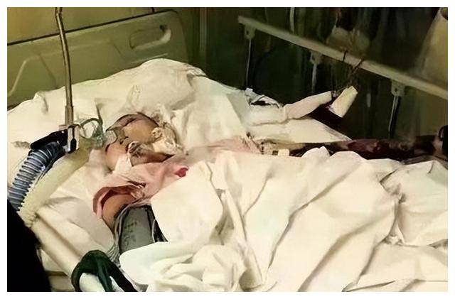 轮的核对和证实,表示该女童的死因是因为,高烧不止而诱发先天性心脏病