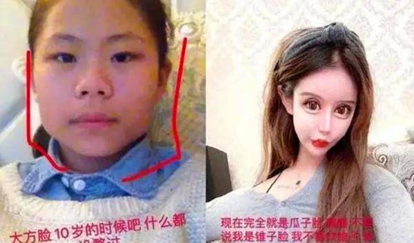 男整容女 全身图片