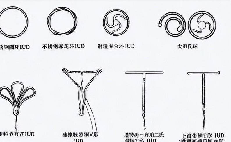 各种节育环,左上角为o型节育环经解剖发现,死者的子宫内有o型小号节育