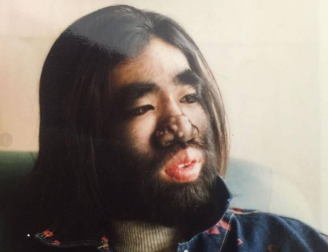 为什么脸上会长毛 为什么脸上会长毛