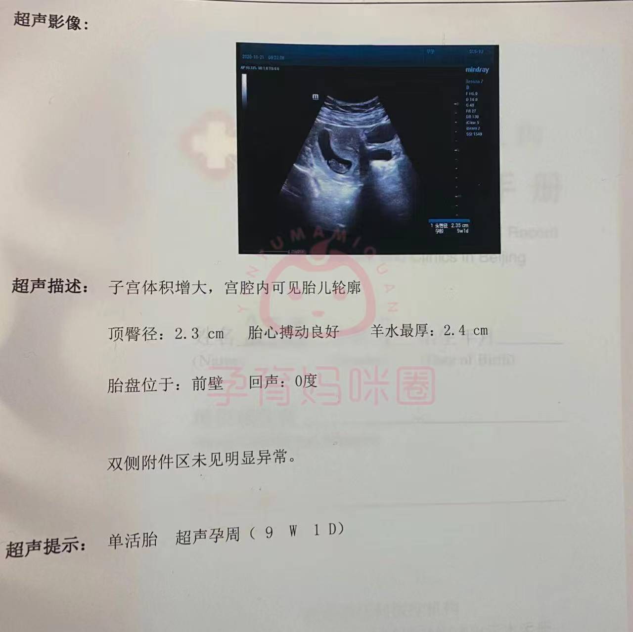 包含北京309医院、协助就诊黄牛票贩子产科建档价格的词条