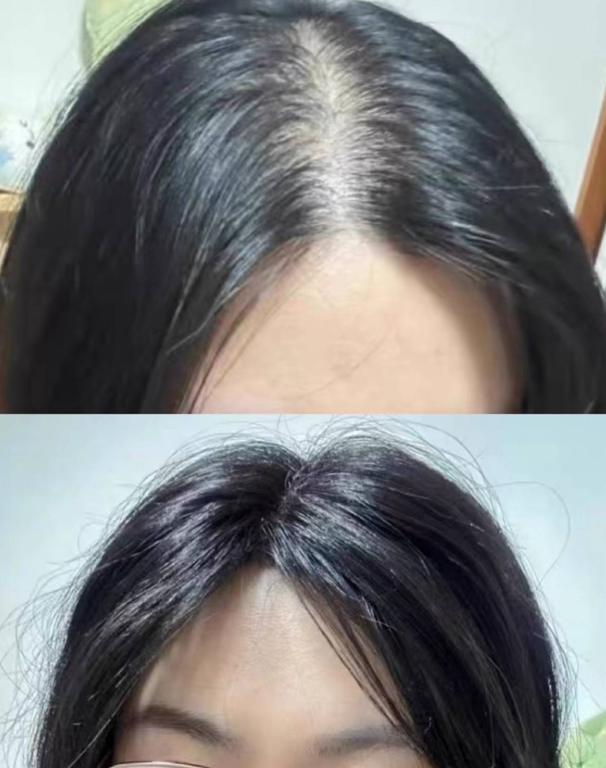 生发育发最有效的产品前十排名育发液什么牌子最有效果?好货安利