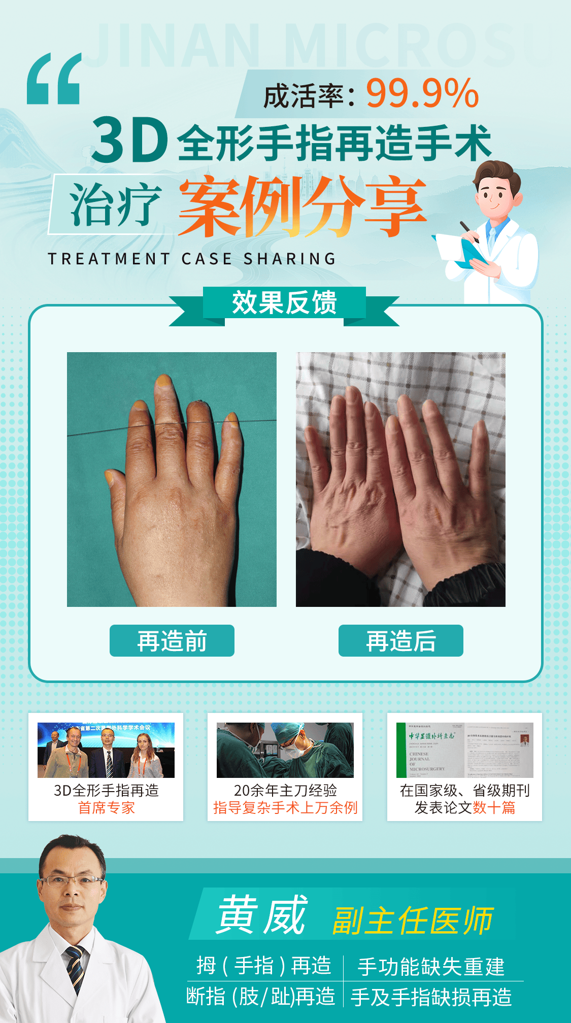 学科优势，3D全形手指再造