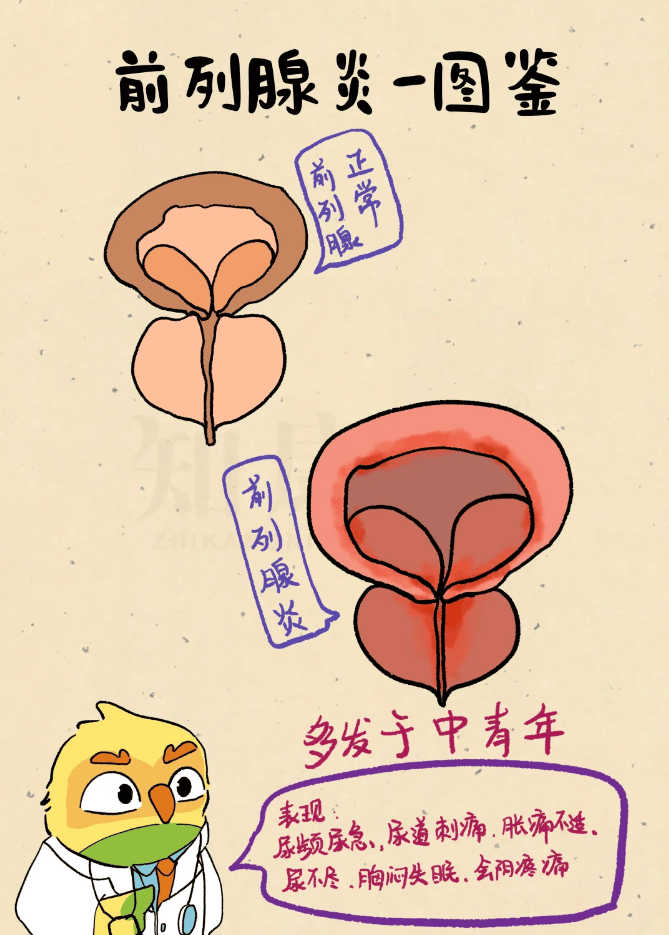 中年男性精力差、前列腺问题咋解？“联合调理”引争议！是奇效还是噱头？