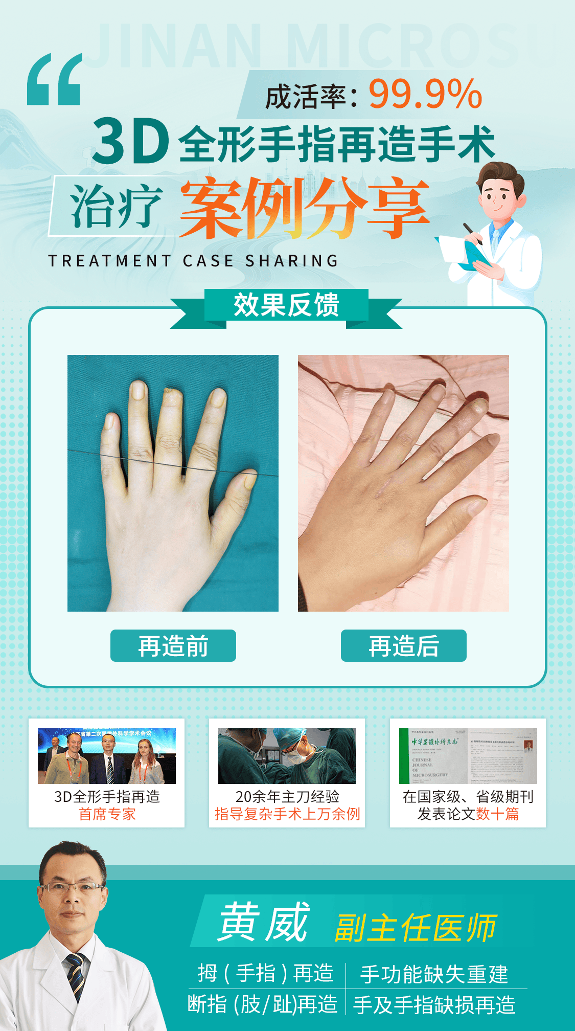 高层次手指再造是恢复伤者正常生理结构功能，并使外观美观
