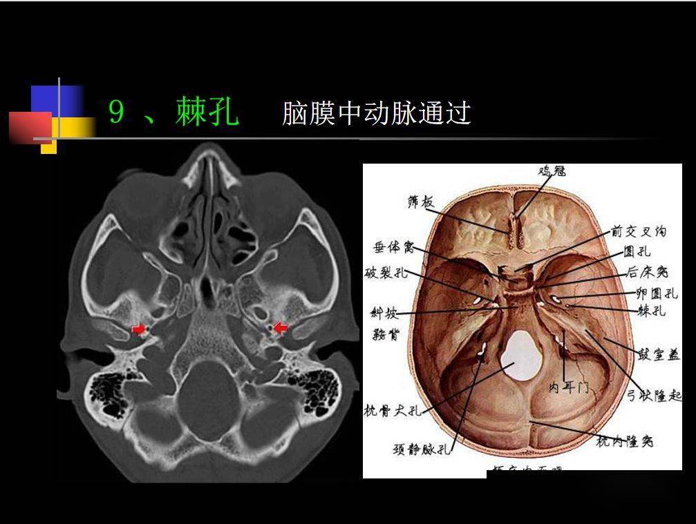 人體鼻咽部及ct的詳細解剖圖分析_全網_影像_淋巴