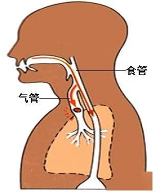 噎食简笔画图片