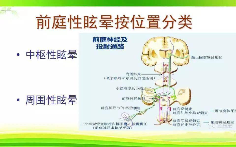 前庭神经核位置图片