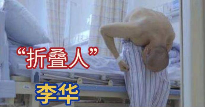 李华先_关节炎_疾病