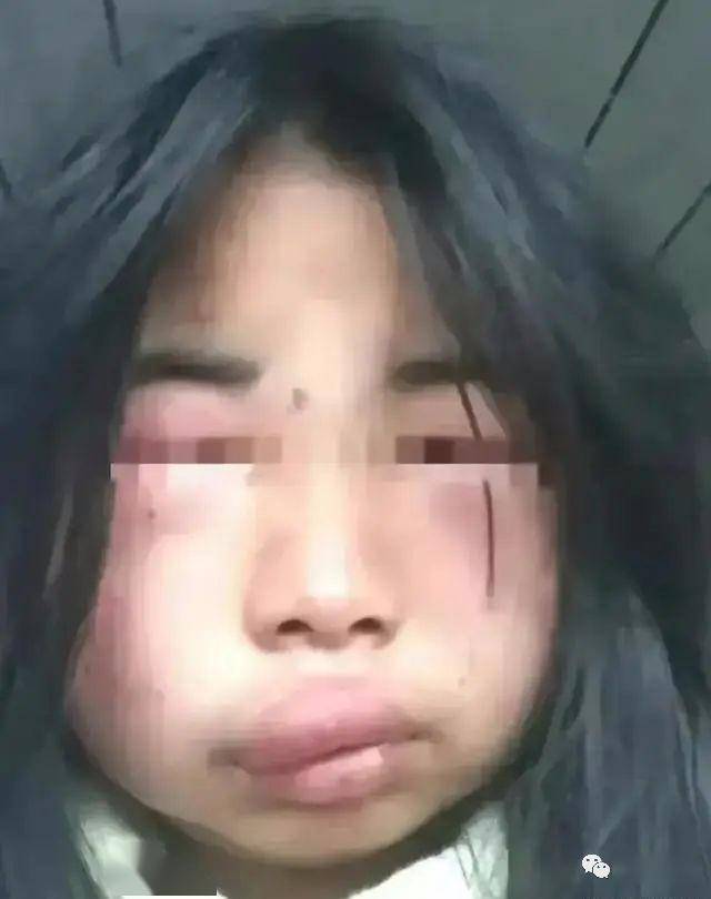 12岁女生被8人扇耳光3小时后续:母亲接受赔偿,女儿已回校上课_校园