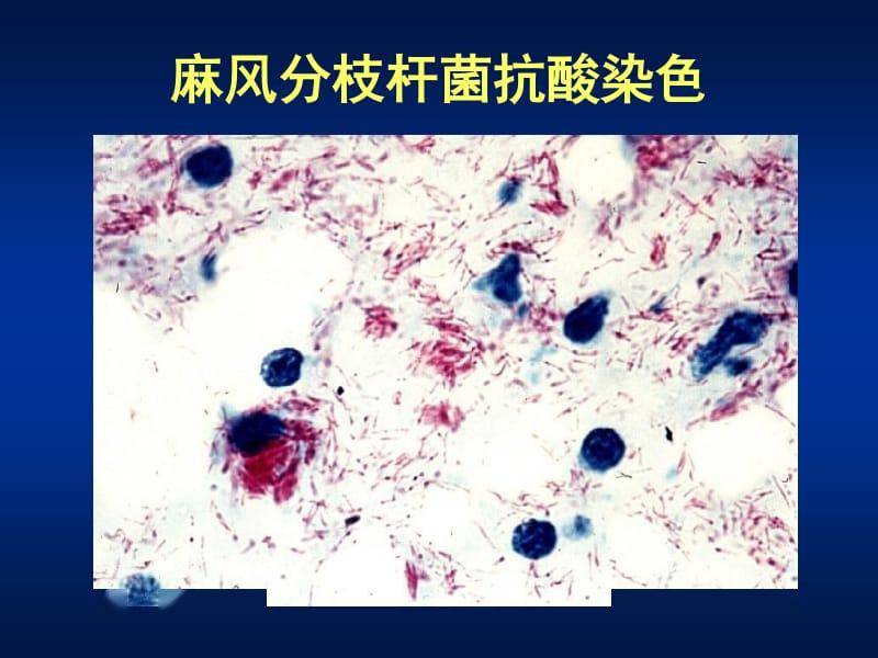 抗酸染色步骤冷染法图片
