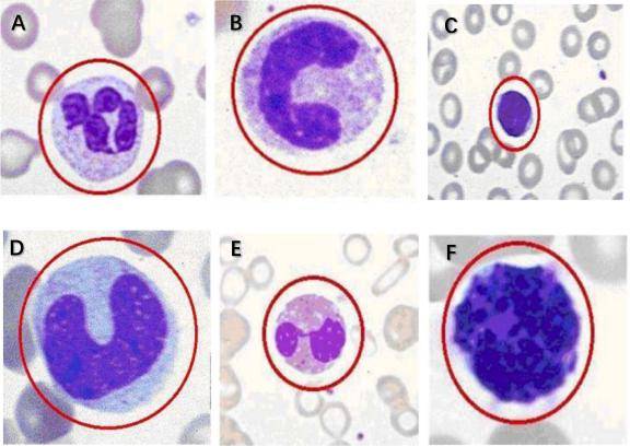 5种白细胞形态绘图图片