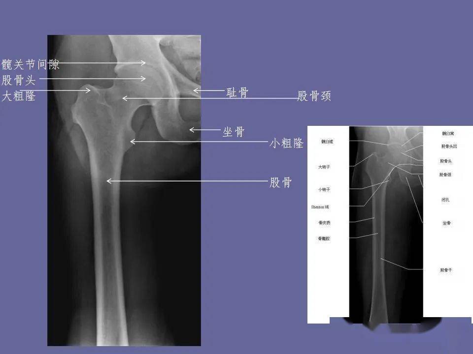 主要從醫學影像頸椎正側位,腰椎正側位及骨盆前後正位體位知識進行了