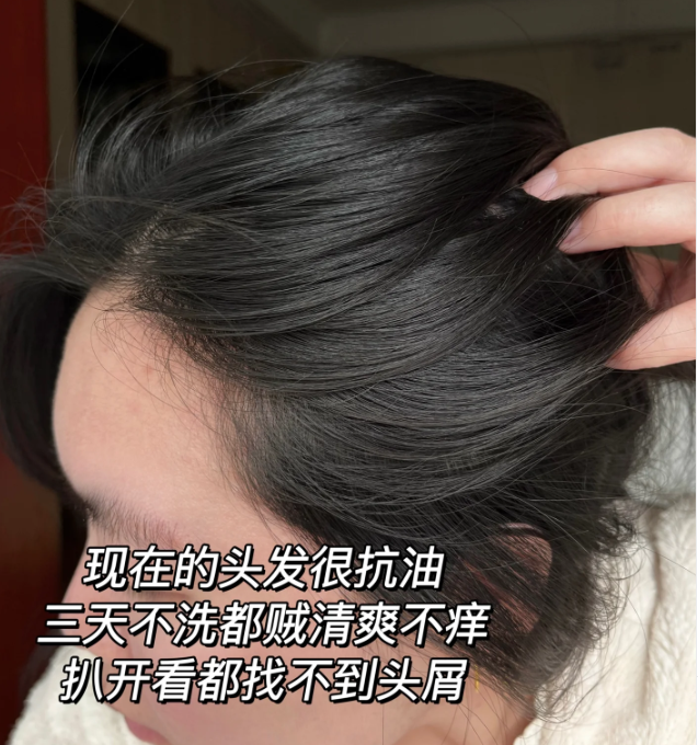 儿童去屑洗发水排行榜前十名_头皮_问题_头发