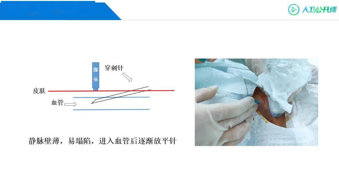 阴囊外面血管小血包图片