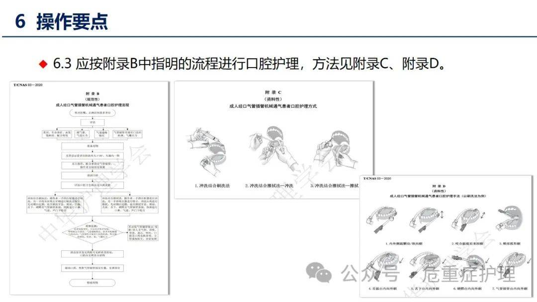 气管插管h型固定图解图片