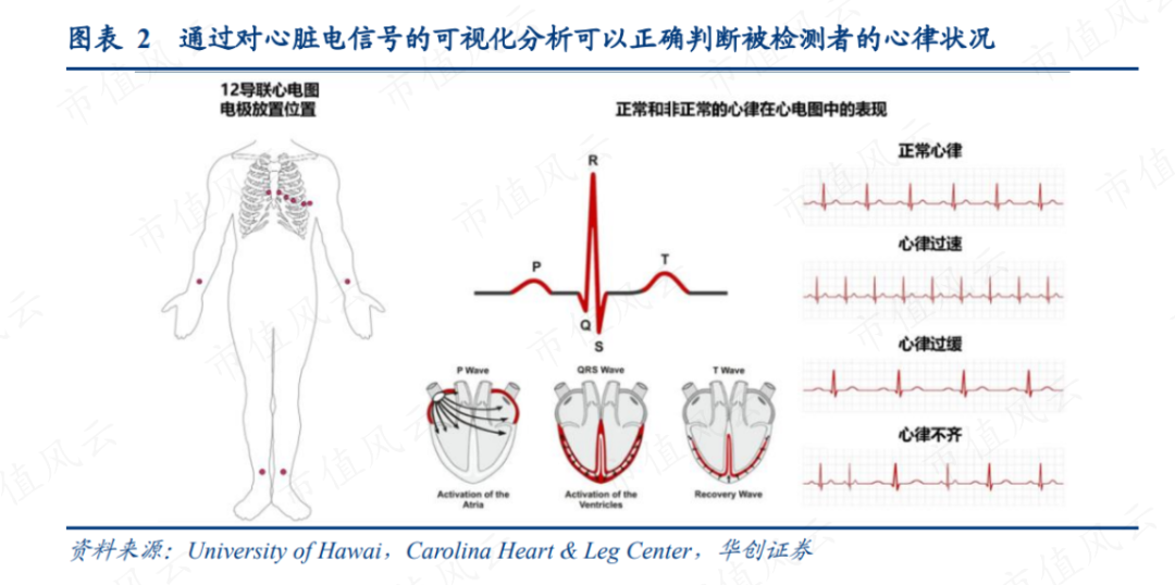 迈瑞收购惠泰控制权:神之一手还是鹰之一手_医疗_生理_心脏