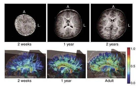 孩子一生僅三次大腦發育高峰期,父母千萬要抓住!_家長