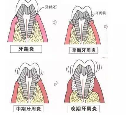 牙床部位图解图片