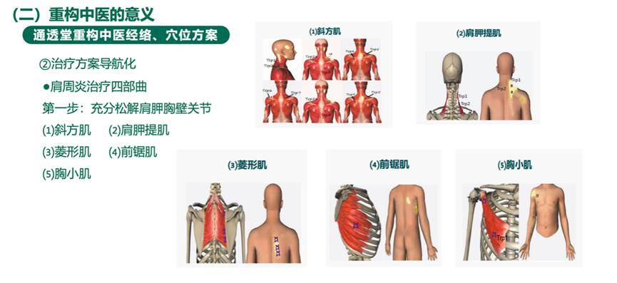 清除其中的問題和相關痛點,以擴大肩關節的活動範圍