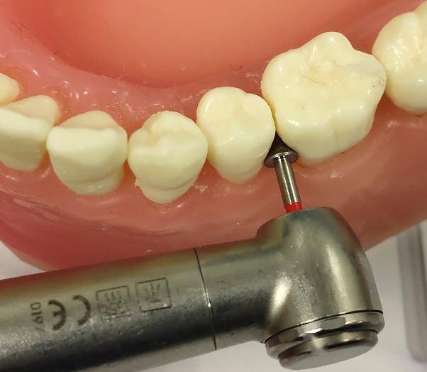 高效,快速——邻面去釉车针_操作_修整_抛光