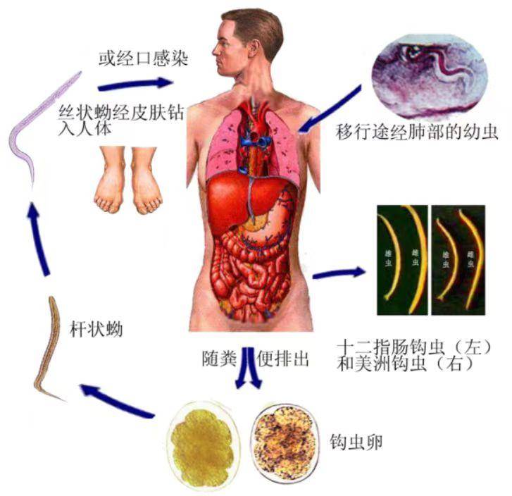 钩虫结构图片