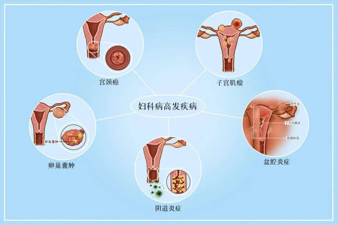 03 恶性疾病子宫肌瘤,子宫内膜息肉,子宫内膜增生,宫颈息肉,宫内节育